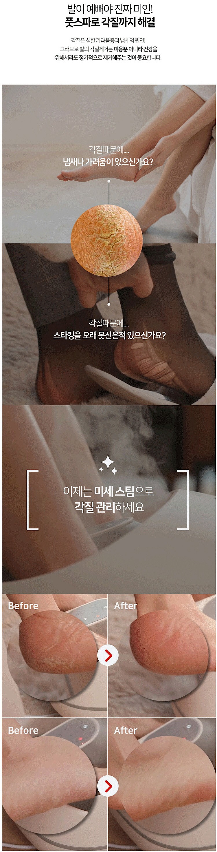 풋스파 스팀 족욕기 (NTFS-120W)_상세페이지