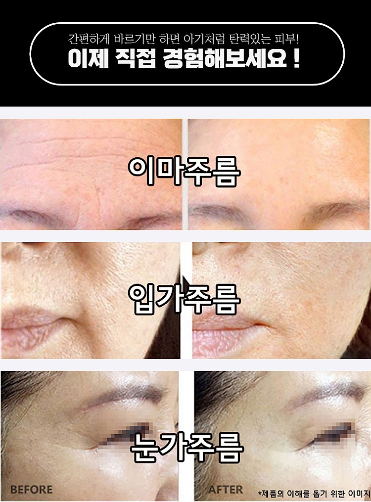 주름잡티 비타민C 앰플_상세페이지