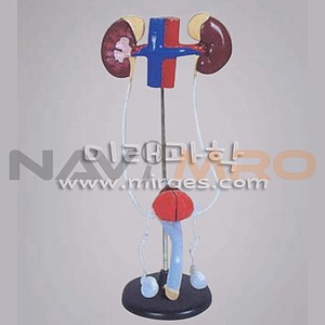 남자 A형 배설계 구조 (MRS1426)