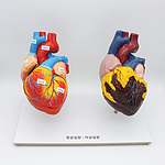 정상심장과 이상심장 (KSIC-6520)