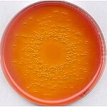 Deoxycholate Lactose Agar