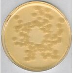 Tryptic soy agar casein-pepton